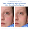 AESTURA | ATOBARRIER365 Cream Moisturizer with Ceramides & Niacinamide for Skin Moisture Barrier Repair