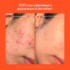 Tower 28 Beauty | SOS Hypochlorous Acid Spray Duo Skincare Set